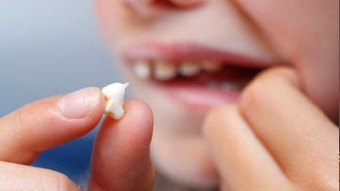 Arti Mimpi Gigi Copot